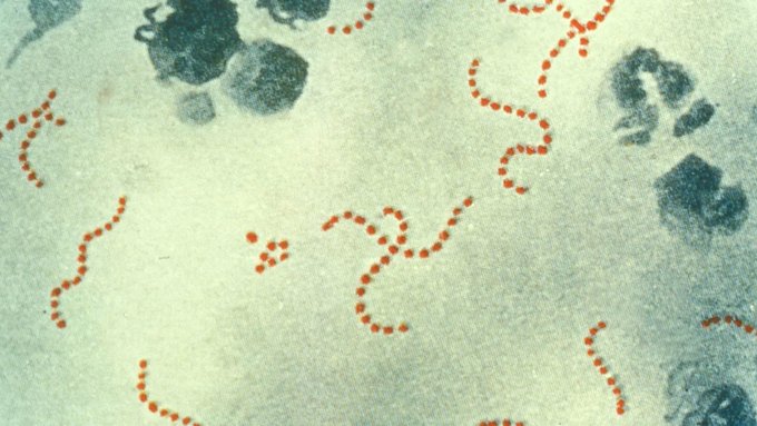 Japón registra cifras récords de infección por un estreptococo 