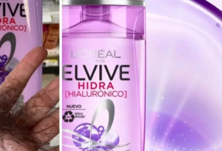 Chile abrirá investigación a L’Oréal por múltiples denuncias contra un champú de la marca que está dejando calva a la gente