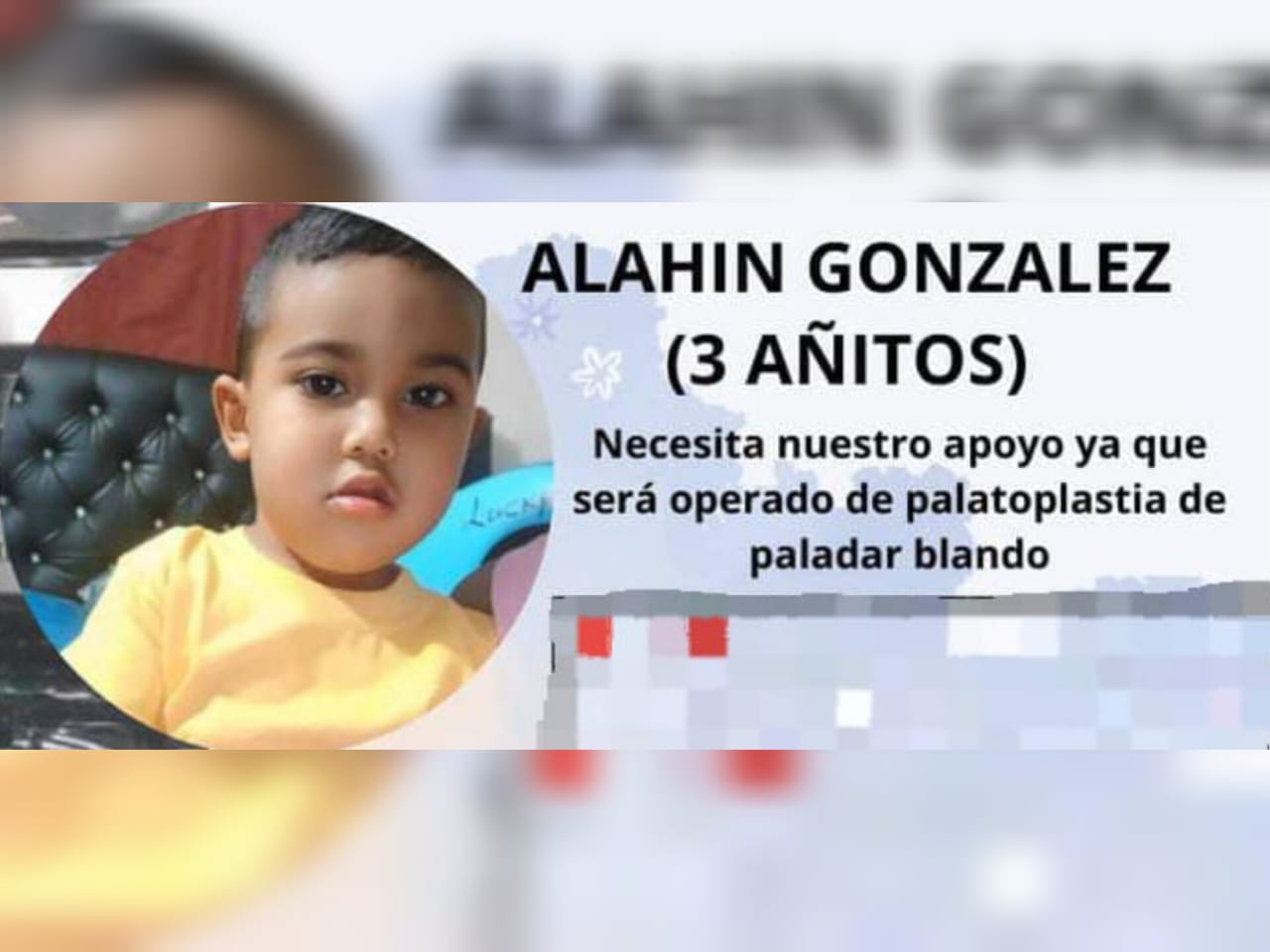 Ayudemos al niño Alahin González para que se le realice una cirugía reconstructiva de paladar