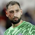 Donnarumma recibió una impactante patada en el rostro durante el duelo del PSG ante Mónaco