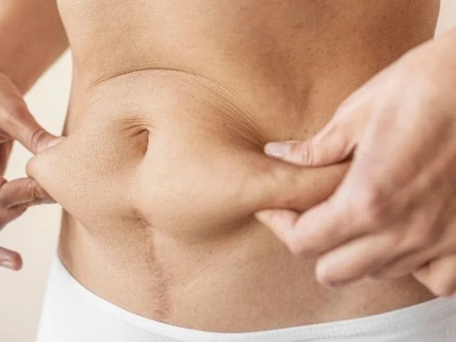 El ejercicio para eliminar la grasa del abdomen en un dos por tres