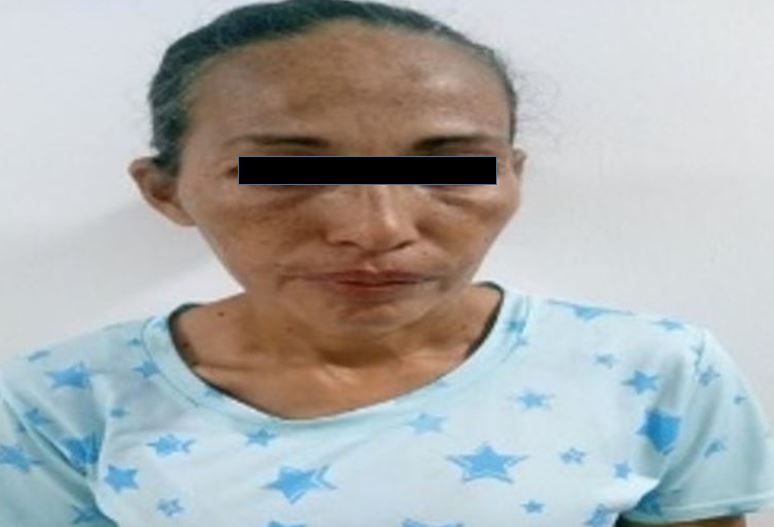 Adolescente de 12 años ingirió un blíster de pastillas anticonvulsivas tras ser agredida por su madre en Falcón