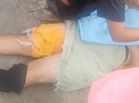 Dos personas heridas al ser impactadas por un carro en el corredor vial Cecilio Acosta