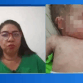 Madre expuso a su bebé de un año para que contrajera una bacteria en Zulia