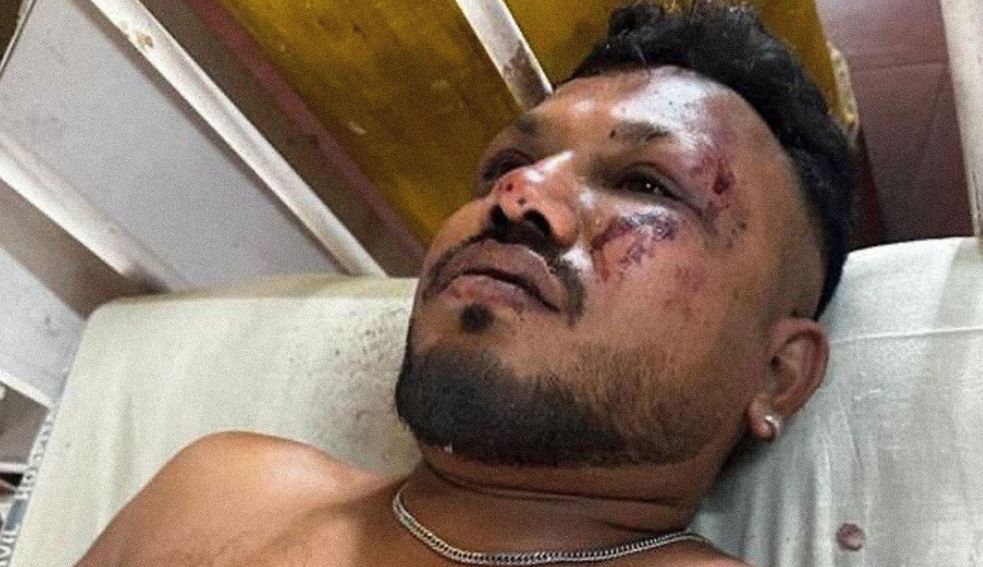 Se salvó al saltar del avión: Único sobreviviente en tragedia del Boeing en India