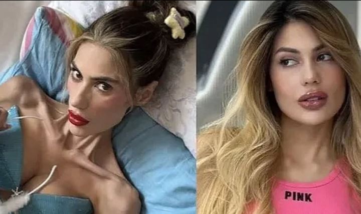 Falleció la influencer turca Nihal Candan a los 30 años tras perder la batalla contra la anorexia