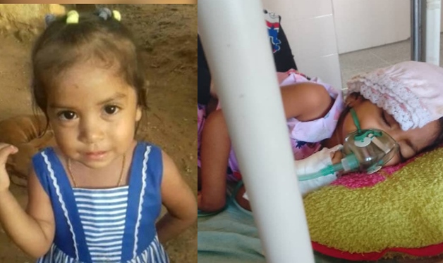 Nohangelis González tiene cuatro años y llora del dolor cuando come: Su familia pide ayuda urgente a gente de buen corazón