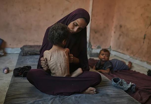 Aumentó a 100 la cifra de niños muertos por desnutrición en Gaza