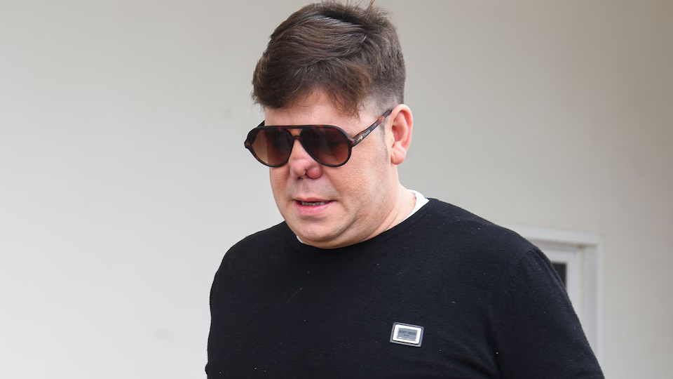 Cantante de Andy y Lucas se hizo una rinoplastia y se le desformó la nariz por no cuidarse