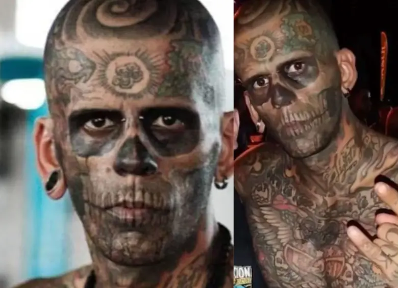Brasileño arrepentido: Se quitó 185 tatuajes de la cara y el cuerpo con doloroso procedimiento laser