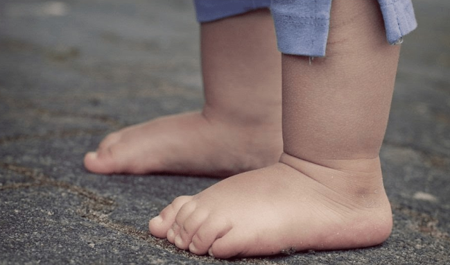 Murió niña de 2 años tras ser arrollada por su padre en Lara