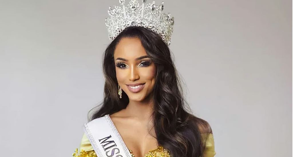 Miss Jamaica 2025 sigue en terapia intensiva tras grave caída