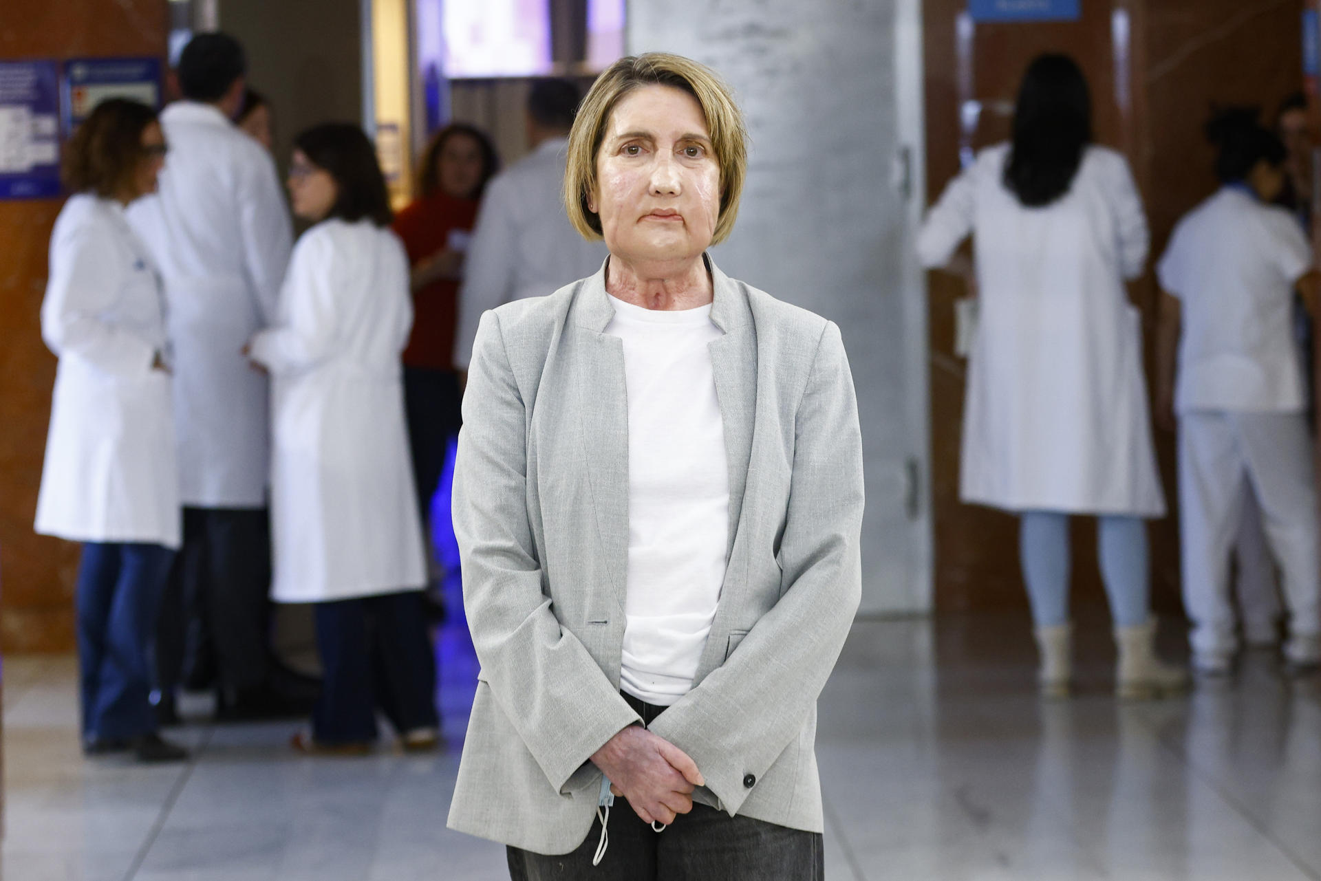 Realizan con éxito el primer trasplante facial del mundo en Barcelona: El donante recibió la eutanasia